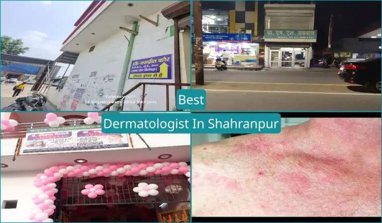 Best Dermatologist In Shahranpur